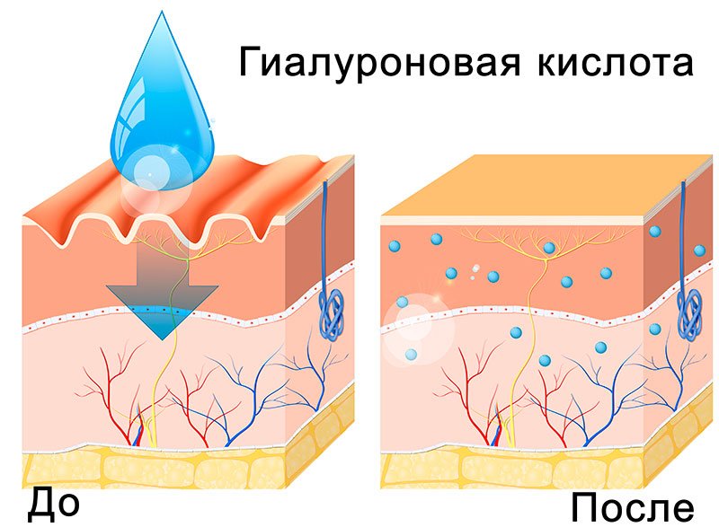 схема: гиалуроновая кислота и эффективность её воздействия на кожу