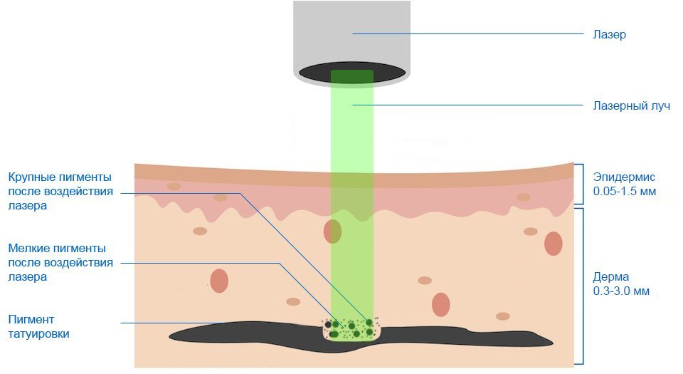процесс воздействия лазерного луча на кожу тела
